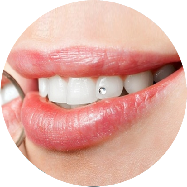 Скайсы на зубы Томск Белинского стоматология в томске на ленина